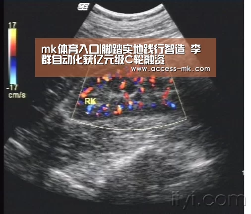 mk体育入口|脚踏实地践行智造 李群自动化获亿元级C轮融资